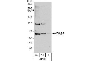 Western Blotting (WB) image for anti-Wiskott-Aldrich Syndrome (Eczema-thrombocytopenia) (WAS) (C-Term) antibody (ABIN7449593)