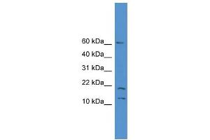 WB Suggested Anti-SNAPC5 Antibody Titration: 0. (SNAPC5 Antikörper  (N-Term))