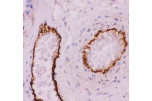Anti-CD31 Picoband antibody,  IHC(P): Human Placenta Tissue (CD31 Antikörper  (AA 28-382))