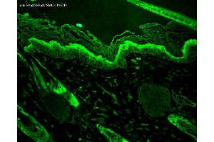 Immunohistochemistry analysis using Mouse Anti-Hsp27 Monoclonal Antibody, Clone 8A7 . (HSP27 Antikörper  (Atto 390))