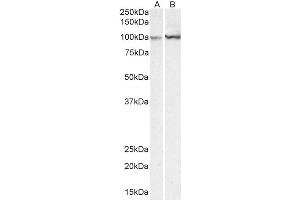 Western Blotting (WB) image for anti-Actinin, alpha 1 (ACTN1) (AA 596-609) antibody (ABIN5857549) (ACTN1 Antikörper  (AA 596-609))