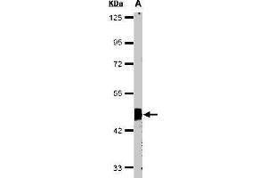 Western blot analysis of 30 ug of whole cell lysate (A:HeLa S3) using a 10 % SDS PAGE gel and Flotillin 2 antibody at a dilution of 1:1000 (Flotillin 2 Antikörper)