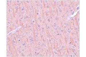 Immunohistochemistry of CCDC106 in rat brain tissue with CCDC106 antibody at 5 μg/ml.