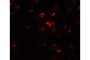 Immunofluorescence (IF) image for anti-Teashirt Zinc Finger Homeobox 2 (tshz2) (N-Term) antibody (ABIN1031648)
