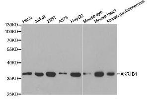 Western blot analysis of extracts of various cell lines, using AKR1B1 antibody. (AKR1B1 Antikörper  (AA 1-316))