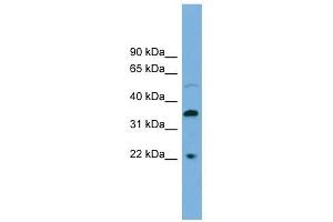 DOK6 antibody used at 1 ug/ml to detect target protein. (DOK6 Antikörper  (Middle Region))