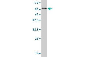 Western Blot detection against Immunogen (81. (EDC3 Antikörper  (AA 1-508))