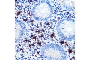 Immunohistochemistry of paraffin-embedded human appendix using Mast Cell Chymase (CM) (CM) Rabbit mAb (1480) at dilution of 1:100 (40x lens). (CMA1 Antikörper)