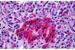 Human Pancreas: Formalin-Fixed, Paraffin-Embedded (FFPE) (NTSR1 Antikörper  (AA 181-230))