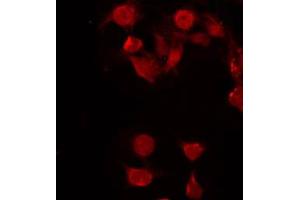 ABIN6272298 staining COLO205 by IF/ICC. (FUBP3 Antikörper  (Internal Region))