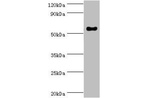 IFNGR1 Antikörper  (AA 270-489)
