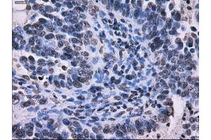 Image no. 13 for anti-Replication Protein A2, 32kDa (RPA2) antibody (ABIN1500735)