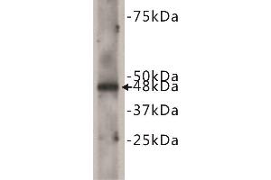 Western Blotting (WB) image for anti-Cadherin EGF LAG Seven Pass G-Type Receptor 2 (CELSR2) antibody (ABIN1854843) (CELSR2 Antikörper)