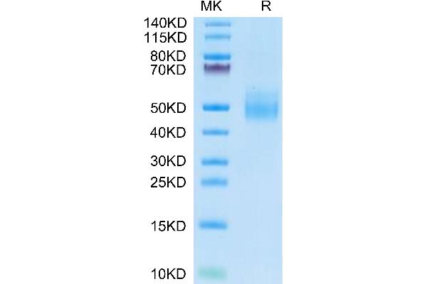 IL-10RA Protein (AA 22-233) (His tag)