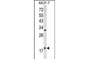 Western blot analysis of ARF3 antibody (Center D93) in MCF-7 cell line lysates (35ug/lane) (ARF3 Antikörper  (AA 78-106))