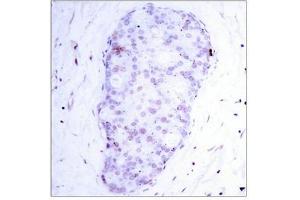 Immunohistochemistry (IHC) image for anti-Nuclear Factor of kappa Light Polypeptide Gene Enhancer in B-Cells 1 (NFKB1) (pSer907) antibody (ABIN7138727)
