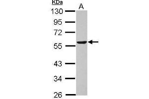 WB Image Sample (30 ug of whole cell lysate) A: U87-MG 10% SDS PAGE antibody diluted at 1:1000 (DLD Antikörper)