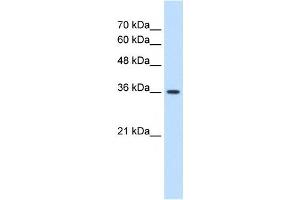 MAS1 antibody used at 1. (MAS1 Antikörper  (Middle Region))