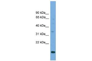 WB Suggested Anti-SLC25A44 Antibody Titration:  0.