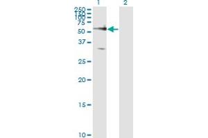 Western Blotting (WB) image for anti-Frizzled Family Receptor 5 (FZD5) (AA 72-161) antibody (ABIN563488)