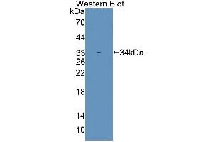 Western blot analysis of the recombinant protein. (SMUG1 Antikörper  (AA 1-270))