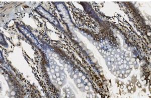IHC analysis of U2AF65/U2AF2 using anti U2AF65/U2AF2 antibody (ABIN7600795).