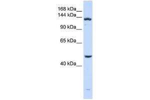 Western Blotting (WB) image for anti-ADAM Metallopeptidase with thrombospondin Type 1 Motif, 18 (ADAMTS18) antibody (ABIN2459683)