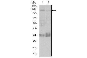 Image no. 2 for anti-Integrin beta 1 (ITGB1) antibody (ABIN1498893) (ITGB1 Antikörper)