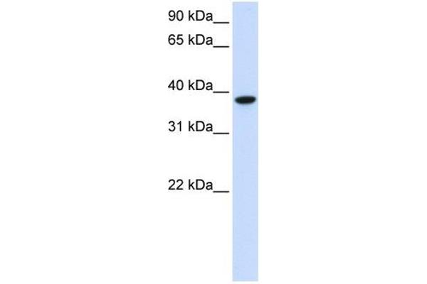 GLT8D2 Antikörper  (C-Term)