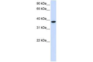 GLT8D2 antibody used at 1 ug/ml to detect target protein. (GLT8D2 Antikörper  (C-Term))