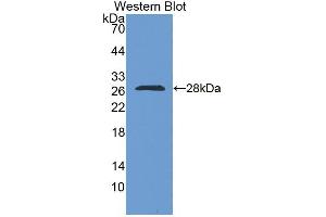 Western blot analysis of the recombinant protein. (RBM38 Antikörper  (AA 25-207))