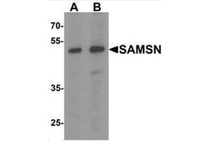 Western blot analysis of SAMSN in Hela cell lysate with SAMSN Antibody  at (A) 0. (SAMSN1 Antikörper  (C-Term))