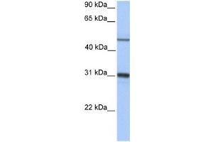 Western Blotting (WB) image for anti-Epoxide Hydrolase 1, Microsomal (Xenobiotic) (EPHX1) antibody (ABIN2459723) (EPHX1 Antikörper)