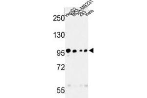 Western Blotting (WB) image for anti-Microtubule Associated serine/threonine Kinase-Like (MASTL) antibody (ABIN3003015) (MASTL Antikörper)