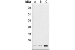 Western blot analysis of HSPE1 expression in HeLa (A), NIH3T3 (B), PC12 (C) whole cell lysates. (HSPE1 Antikörper  (Center))