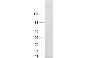 Western Blotting (WB) image for Integrin beta 4 (ITGB4) (Transcript Variant 1) protein (Myc-DYKDDDDK Tag) (ABIN2713356)