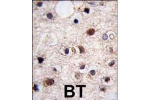 Formalin-fixed and paraffin-embedded human brain tissue reacted with JMJD3 (N-term) (ABIN387862 and ABIN2844039) , which was peroxidase-conjugated to the secondary antibody, followed by DAB staining. (Kdm6b Antikörper  (N-Term))