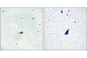 Immunohistochemistry analysis of paraffin-embedded human brain tissue, using NCOR2 Antibody.
