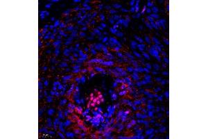 Immunofluorescence (Paraffin-embedded Sections) (IF (p)) image for anti-Prothymosin, alpha (PTMA) antibody (ABIN7075306)