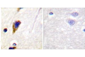 Peptide - +Immunohistochemical analysis of paraffin-embedded human brain tissue using Dynamin-1 (Ab-774) Antibody (#B0422). (Dynamin 1 Antikörper  (Ser774))