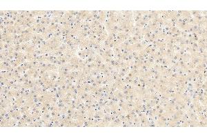 Detection of VEGF165 in Porcine Liver Tissue using Monoclonal Antibody to Vascular Endothelial Growth Factor 165 (VEGF165) (VEGF 165 (AA 28-191) Antikörper)