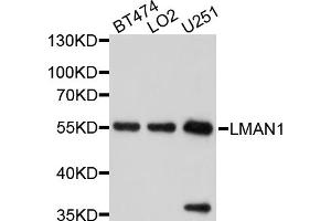 Western blot analysis of extracts of various cell lines, using LMAN1 antibody (ABIN5998142) at 1/1000 dilution. (LMAN1 Antikörper)