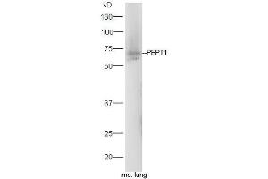 Mouse lung lysates probed with Rabbit Anti-PEPT1 Polyclonal Antibody, Unconjugated (ABIN2559661) at 1:300 in 4˚C. (SLC15A1 Antikörper  (AA 421-520))