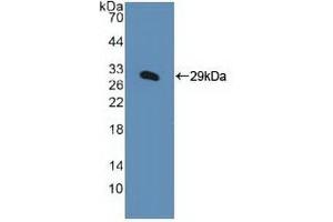 Detection of Recombinant KPNa1, Human using Polyclonal Antibody to Karyopherin Alpha 1 (KPNa1) (KPNA1 Antikörper  (AA 239-506))
