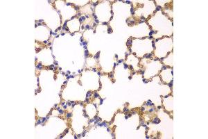 Immunohistochemistry of paraffin-embedded mouse lung using EPB41 antibody at dilution of 1:200 (400x lens). (EPB41 Antikörper)