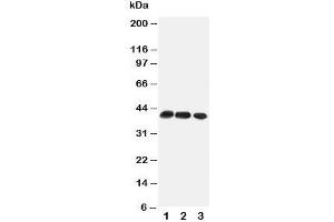 Western blot testing of CCR4 antibody and Lane 1:  mouse thymus;  2: mouse spleen;  3: (m) HEPA cell lysate (CCR4 Antikörper  (Middle Region))