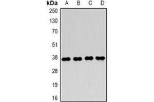 Western blot analysis of LDHA expression in MCF7 (A), Jurkat (B), NIH3T3 (C), mouse skeletal muscle (D) whole cell lysates. (Lactate Dehydrogenase A Antikörper)