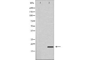 Western blot analysis of extracts of Raji , using BIK antibody. (BIK Antikörper  (N-Term))