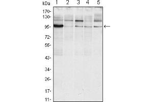 Western blot analysis using ERN1 mouse mAb against Raji (1), A431 (2), Jurkat (3), Hela(4) and HEK293 (5) cell lysate. (ERN1 Antikörper)