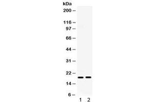 Western blot testing of 1) mouse ovary and 2) mouse HEPA lysate with IP10 antibody. (CXCL10 Antikörper  (AA 22-98))